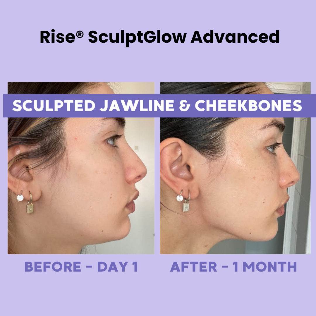 Rise® SculptGlow Advanced